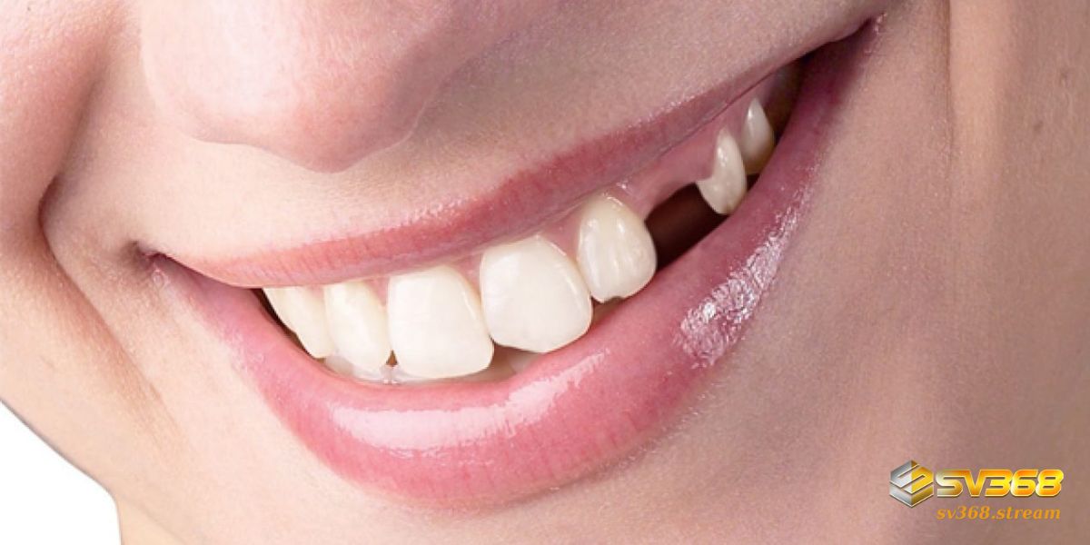 Nằm mơ thấy rụng răng và gãy thành mảnh nhỏ